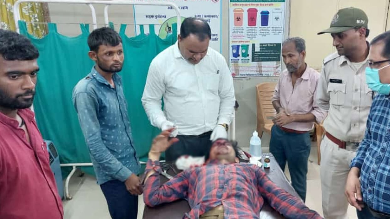 Forest workers sent the villager to catch the monkey in Damoh, the monkey attacked