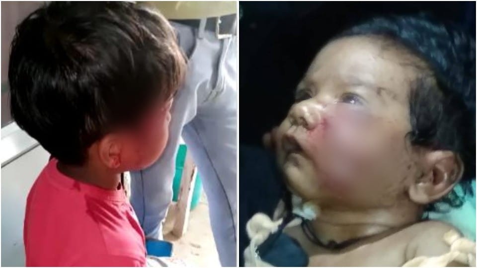 Monkeys attacks two children in Tundla Firozabad