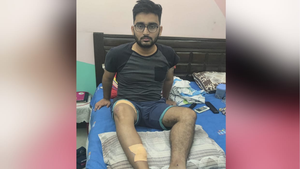 dog attacked young man in Ghazibad, grabbed his feet and dragged him for 100 meters