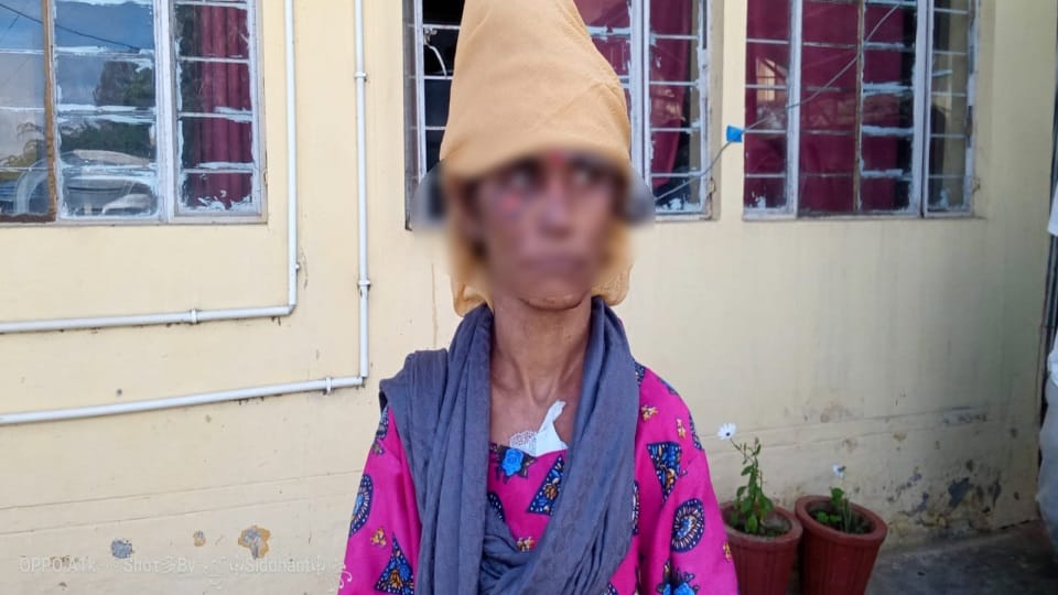 Daughter in law harassment case: Preeti is in depression and got anemia due to lack of food