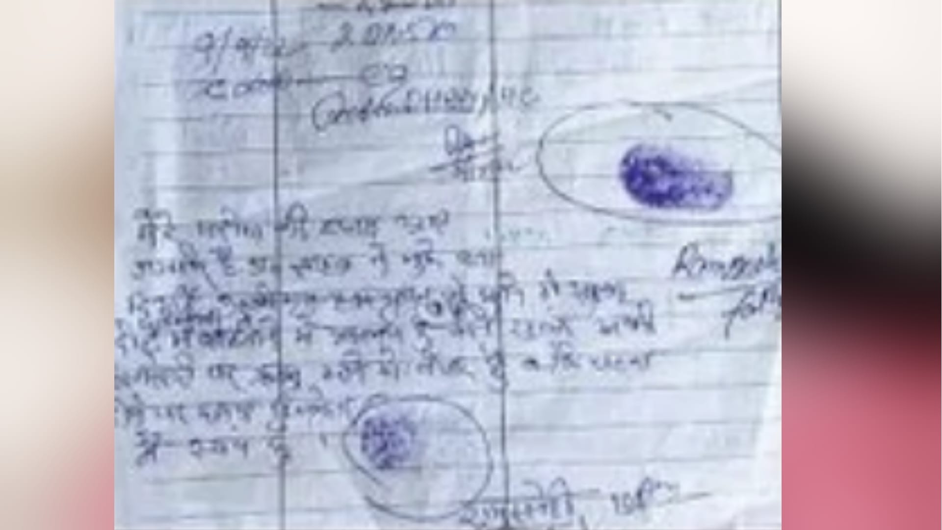 Pilibhit Burned alive after rape 30 thousand were raised for marriage father wrote on doctor prescription