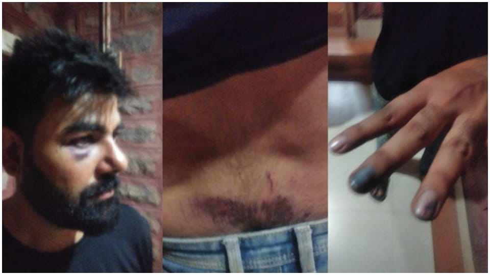 Two Constable Beat young man in jodhpur broke his teeth and fingers
