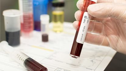 Dengue Update: दिल्ली में डेंगू-मलेरिया के बढ़े मामले, दोनों के ज्यादातर लक्षण लगभग समान फिर कैसे करें अंतर? dengue and malaria symptoms and risk management How do I know if I have malaria or dengue