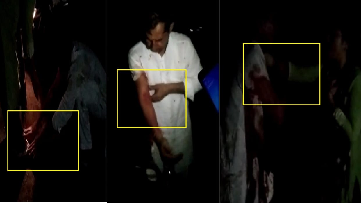 The dog attacked on accused after molesting the woman in Shamli see photos