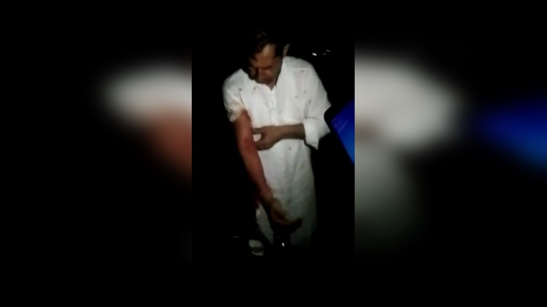 The dog attacked on accused after molesting the woman in Shamli see photos