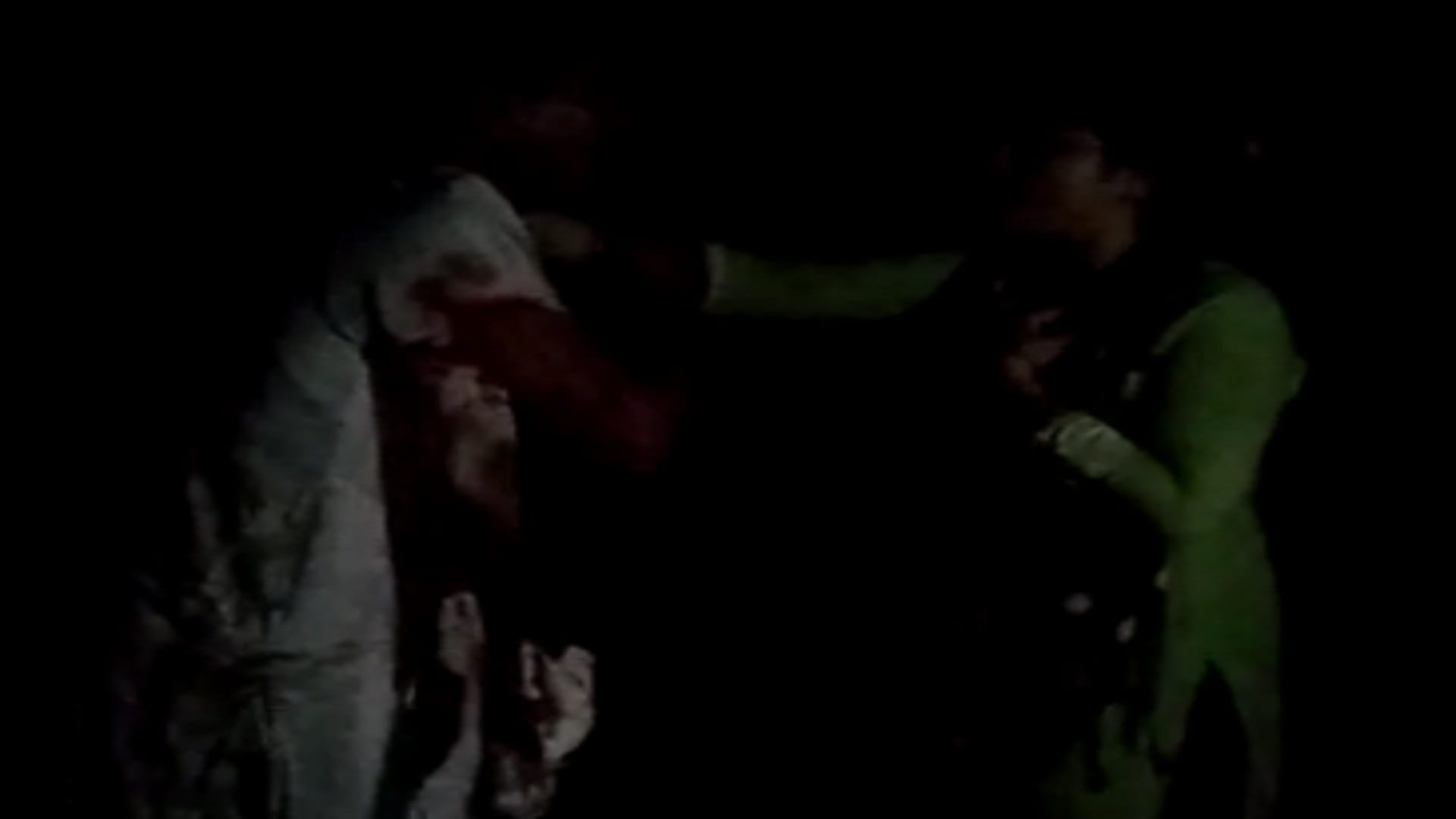 The dog attacked on accused after molesting the woman in Shamli see photos