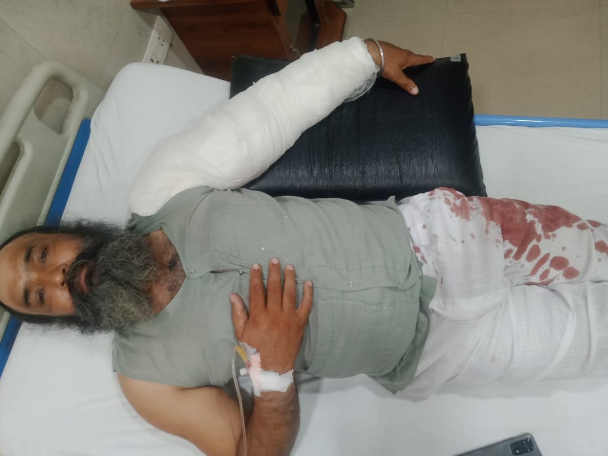 Firing in Kashipur