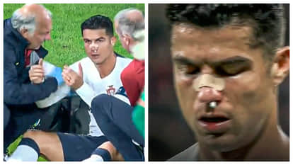 Nations League Cristiano Ronaldo was badly injured against the Czech Republic blood came out Portugal won
