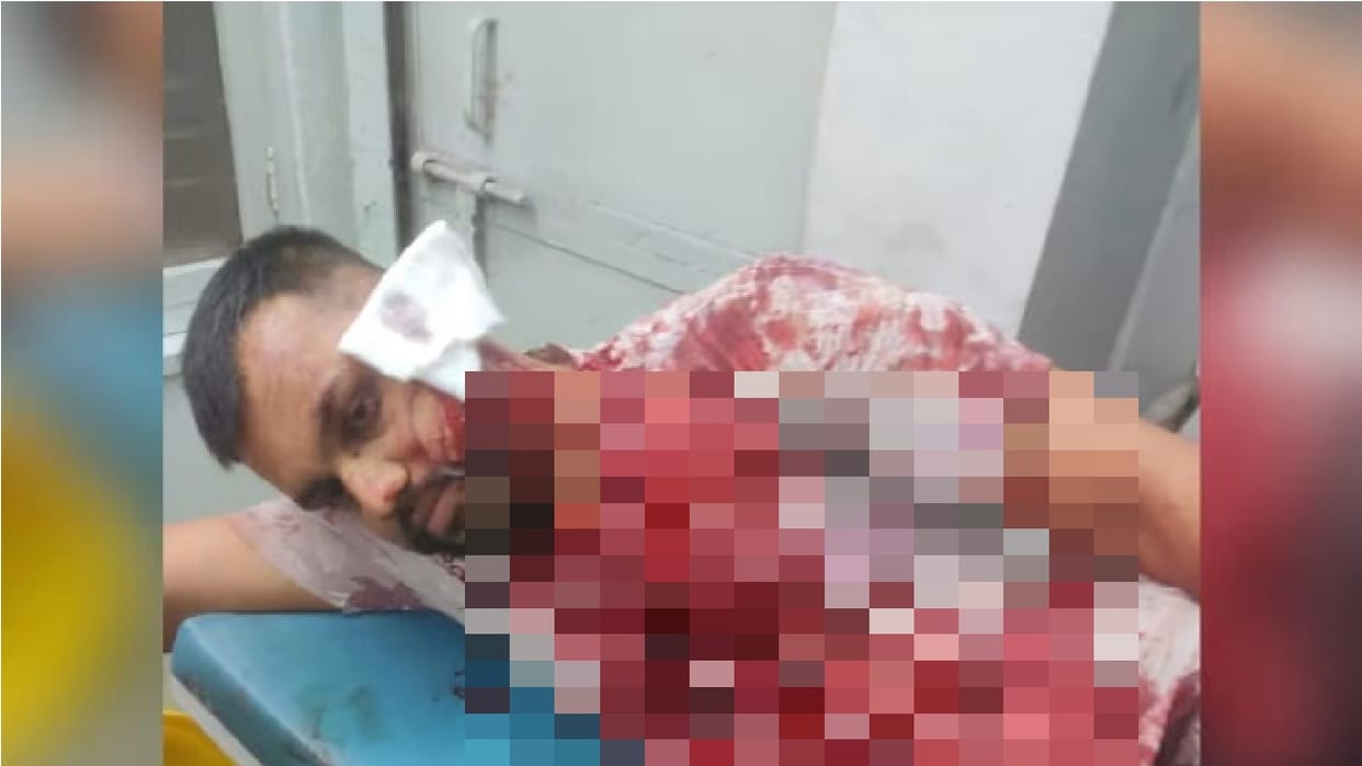 attempt to kill youths who arrived to help girl after seeing message on Instagram in chhattisgarh bhilai