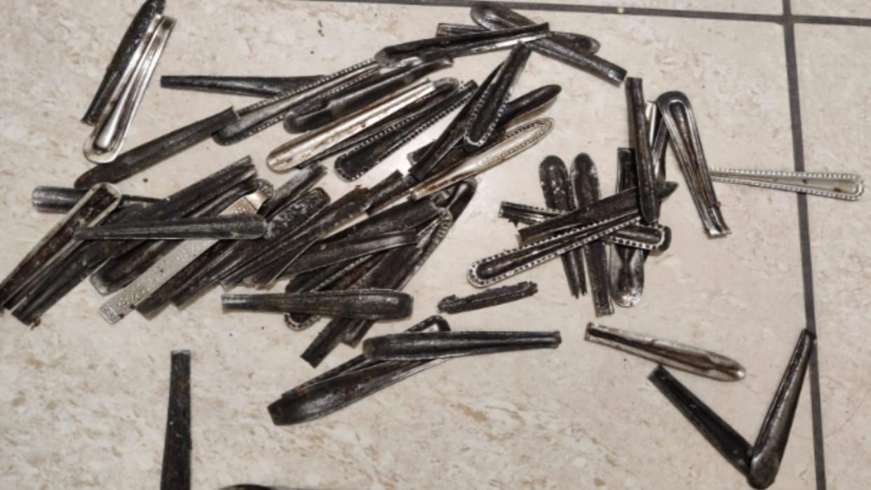 Unique case: 63 spoons came out of the stomach of a youth in Muzaffargar
