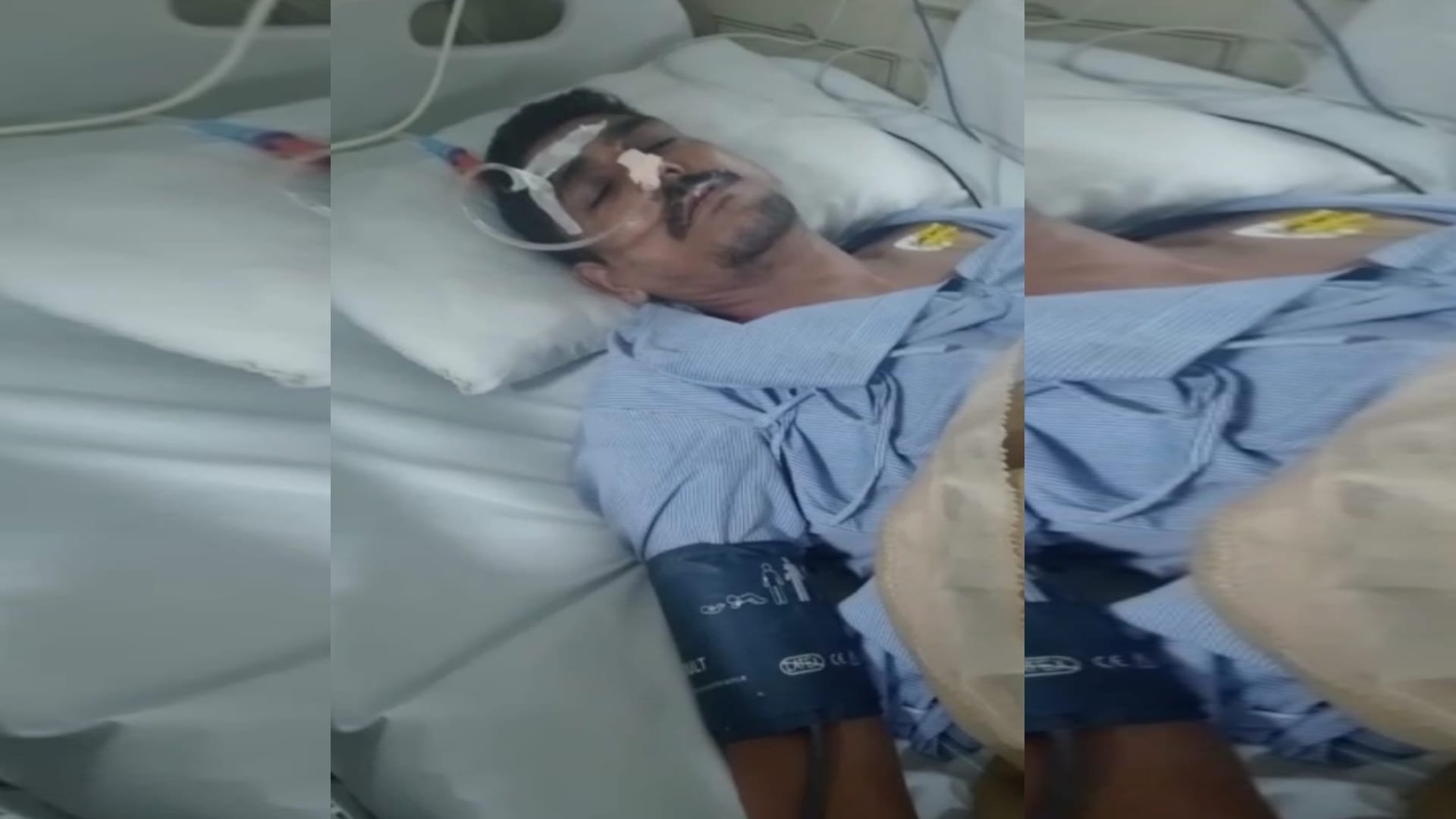 Doctors Removed more than Sixty Spoons from a man Stomach in Muzaffarnagar