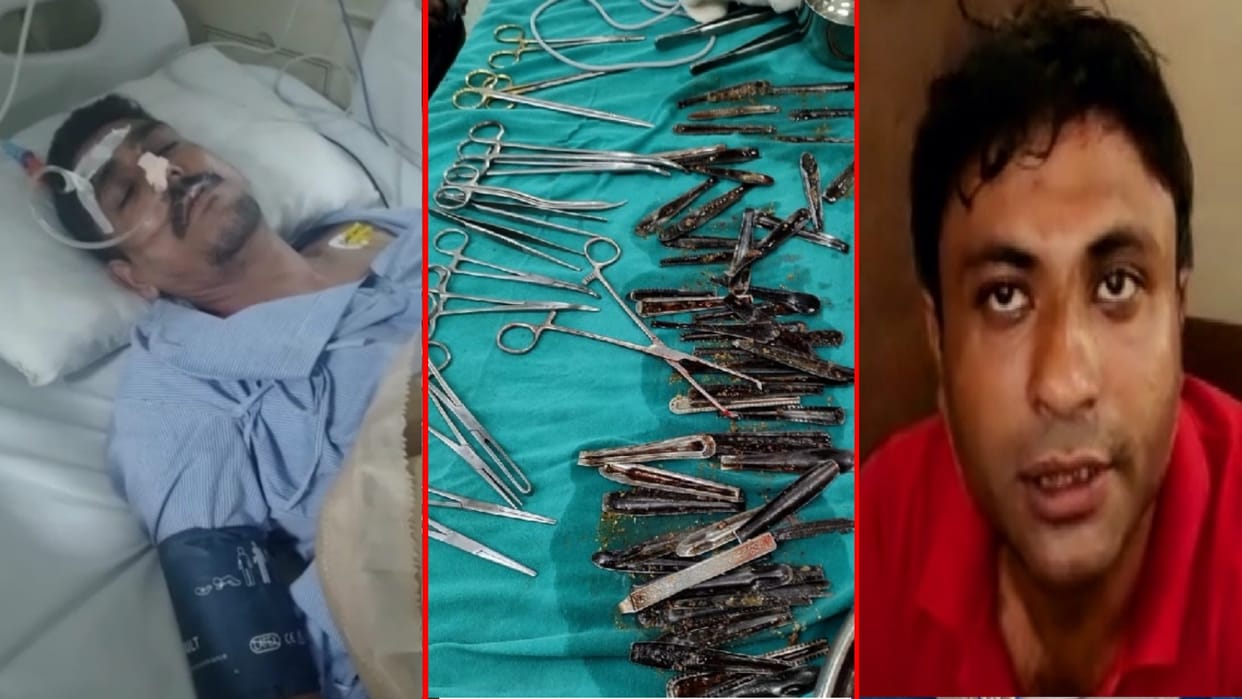 Doctors Removed more than Sixty Spoons from a man Stomach in Muzaffarnagar