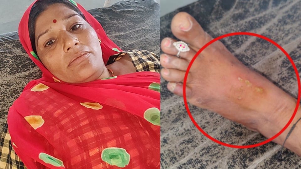 Snake bitten the woman thrice in four days, still alive