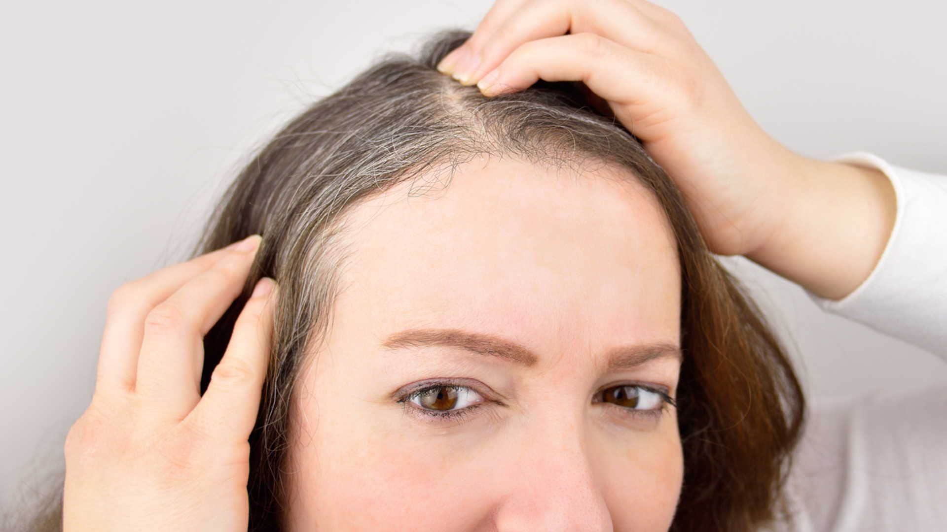 study says Alopecia and grey hair are associated with COVID-19 Severity, know its risk factors