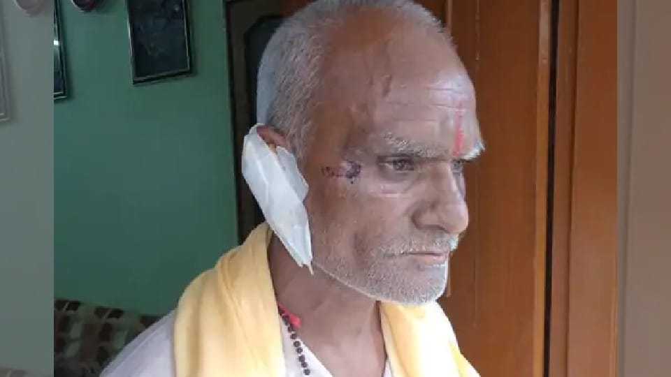 Rajasthan Pandit beaten up in Indore, ears cut off with teeth