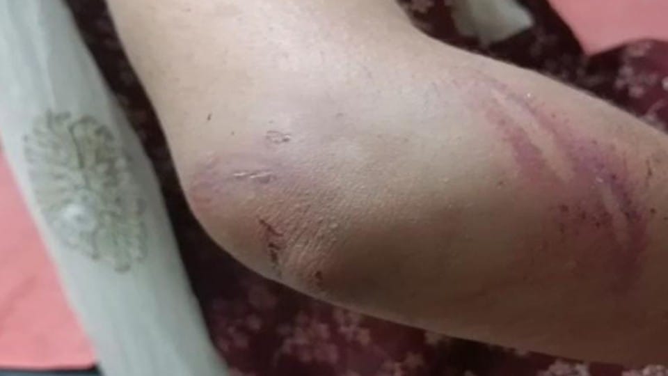 police officer husband beat wife with iron rod in etah