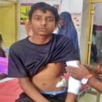 घायल बच्चे का इलाज जारी
