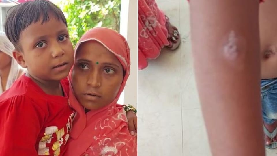 six-year-old girl beaten up by her aunt and aunt with hot tongs in mainpuri