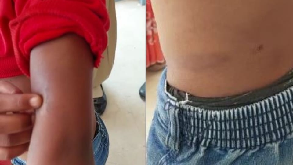 six-year-old girl beaten up by her aunt and aunt with hot tongs in mainpuri