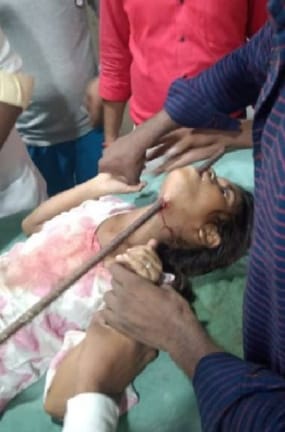 The rod entered the neck of the innocent who went to graze the goat, the condition was critical