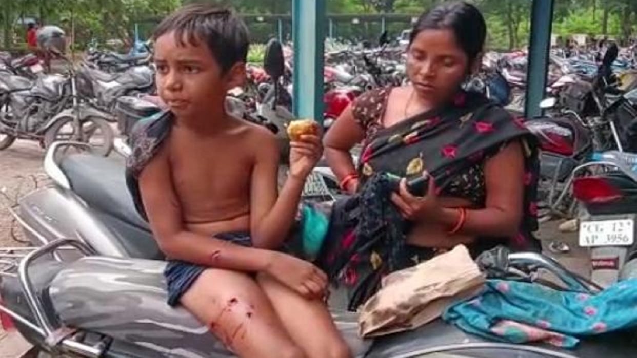 Chhattisgarh 10 Year Old Boy Brutally Attacked By Stray Dog In Korba
