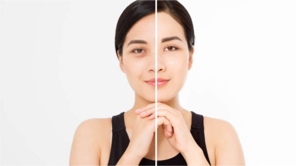 get rid of dark circles do changes in routine