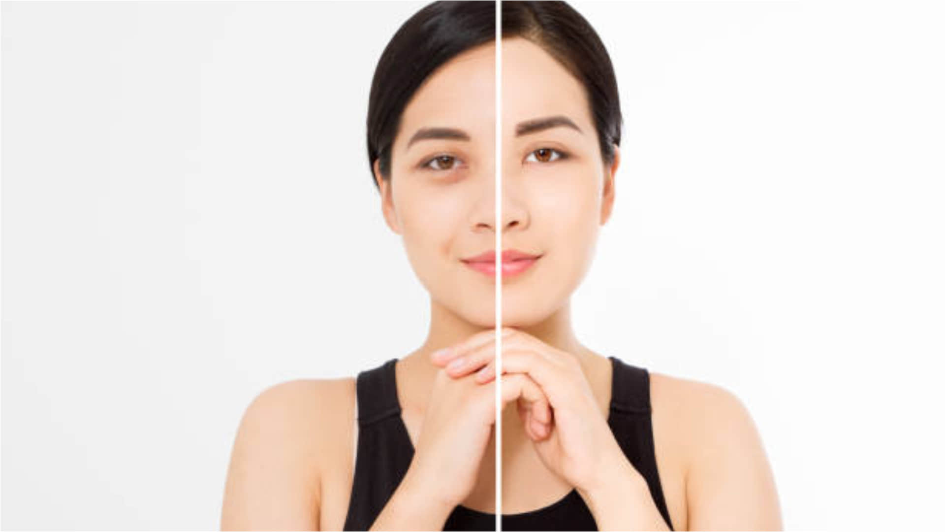 how to use potato on face for get rid of dark circles and dark spots