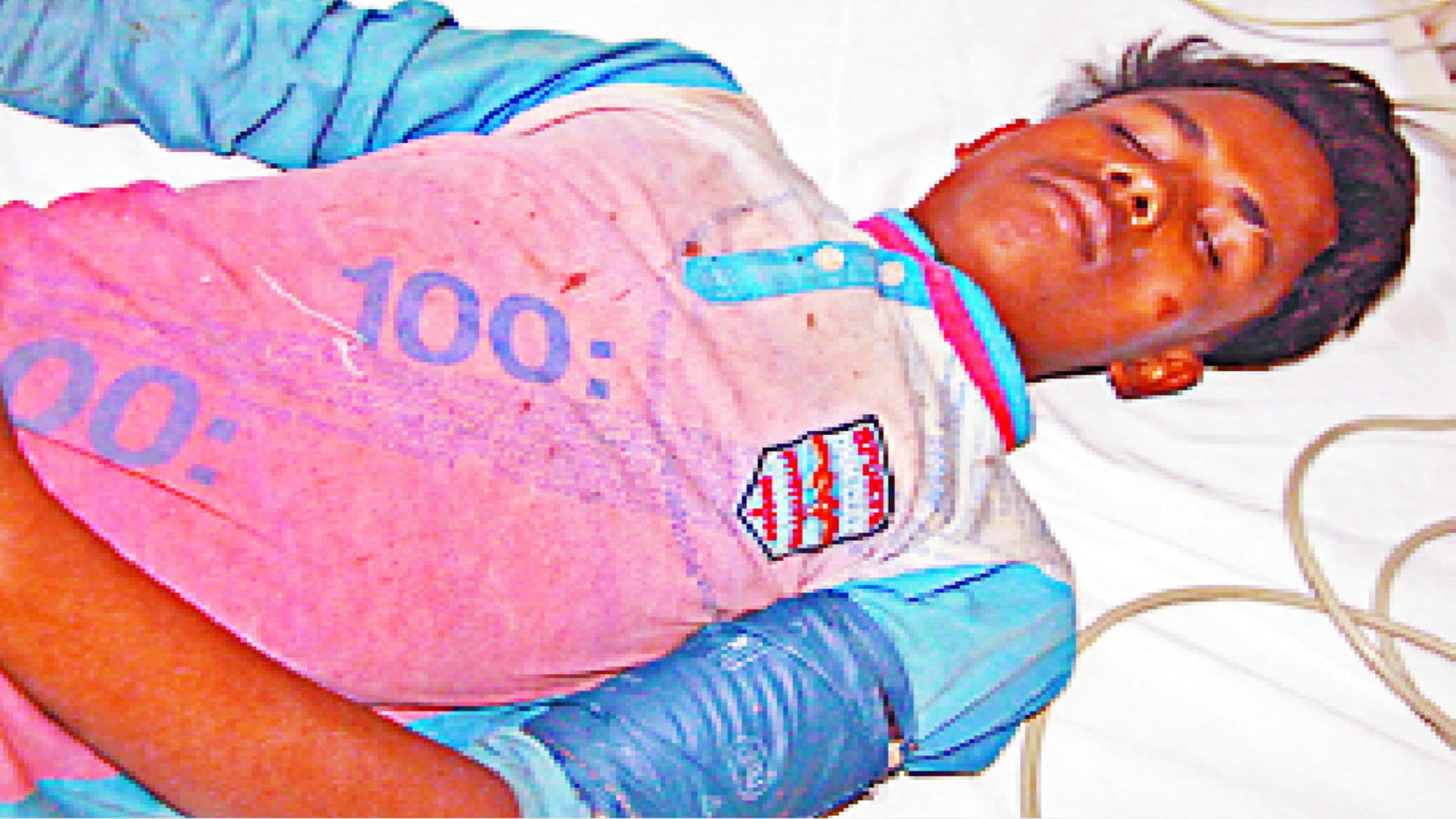 Meerut: Teenager fell 20 feet from car colliding with bikes, two others injured