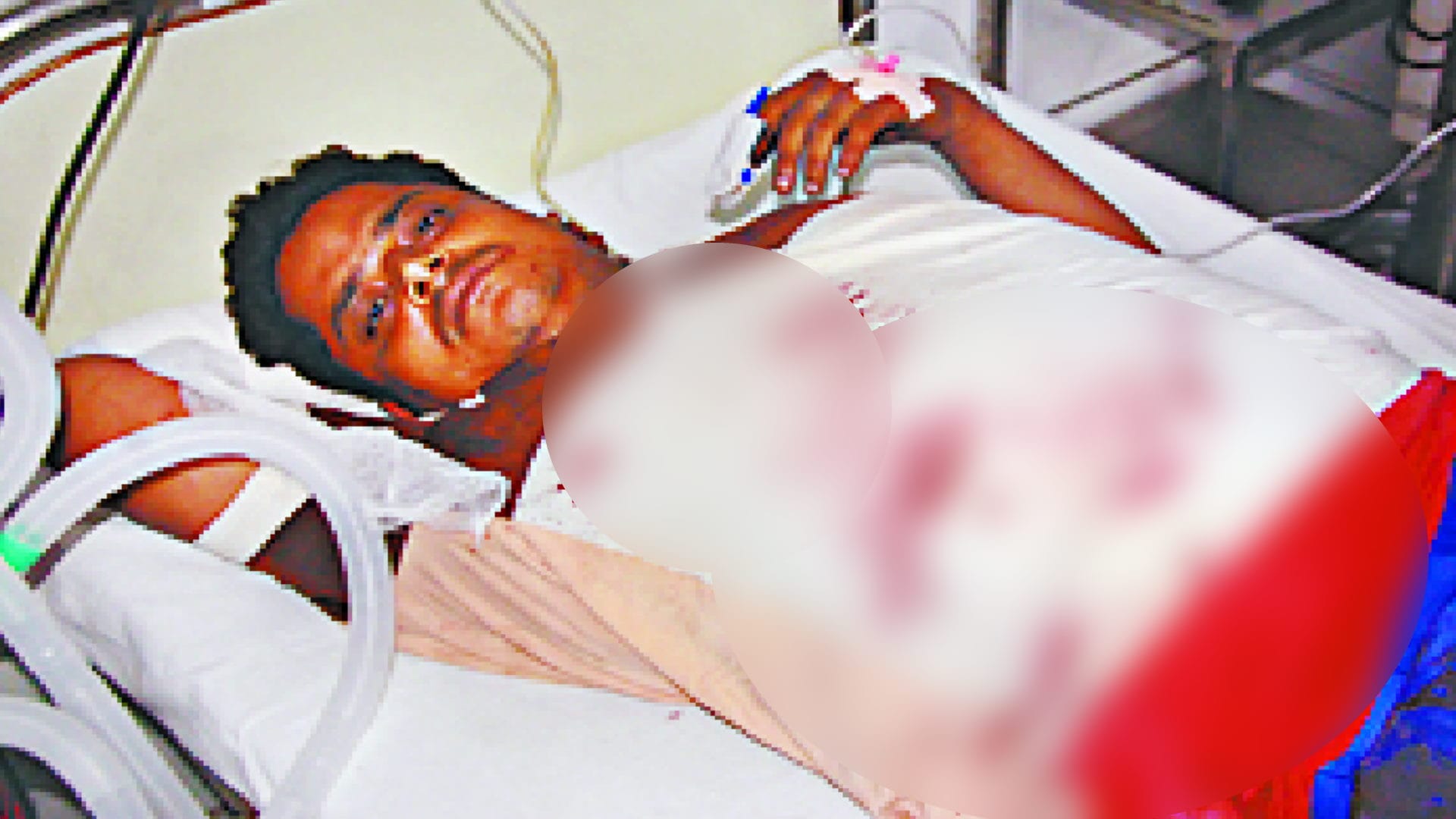 Meerut: Teenager fell 20 feet from car colliding with bikes, two others injured