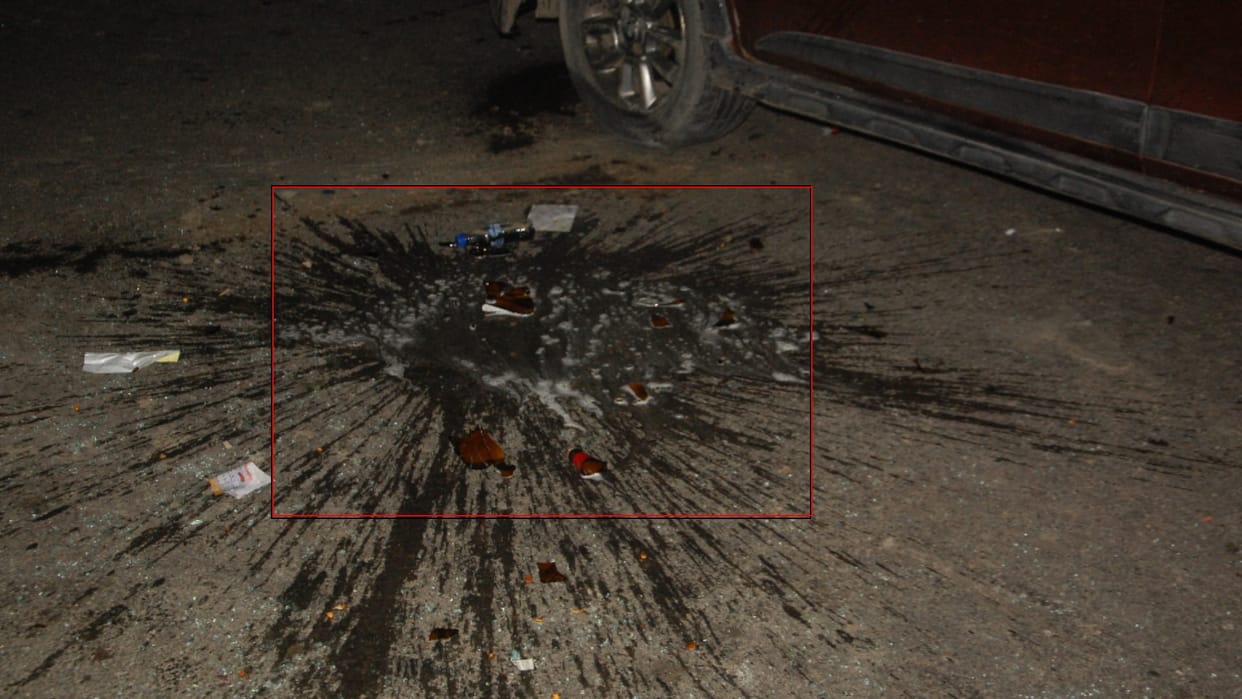 Bottle hit in seller's head for asking for beer money case filed