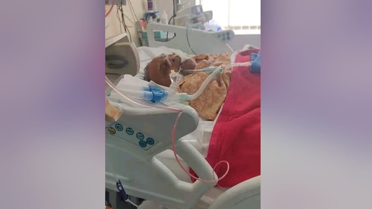 Mulayam Singh Yadav Health Condition Remains Critical Still in ICU of Gurugram Hospital News in Hindi