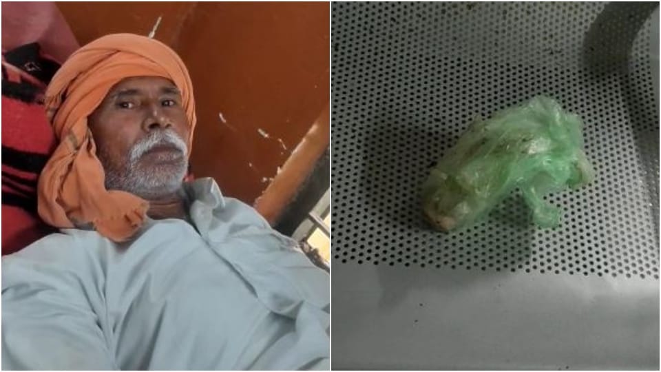 Elderly Man Reached The Hospital With The Snake In Firozabad