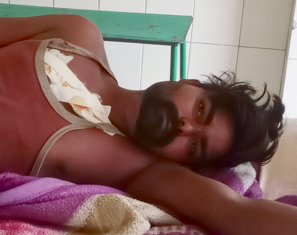 The contractor injured the young man by stabbing him when the bike collided with the car
