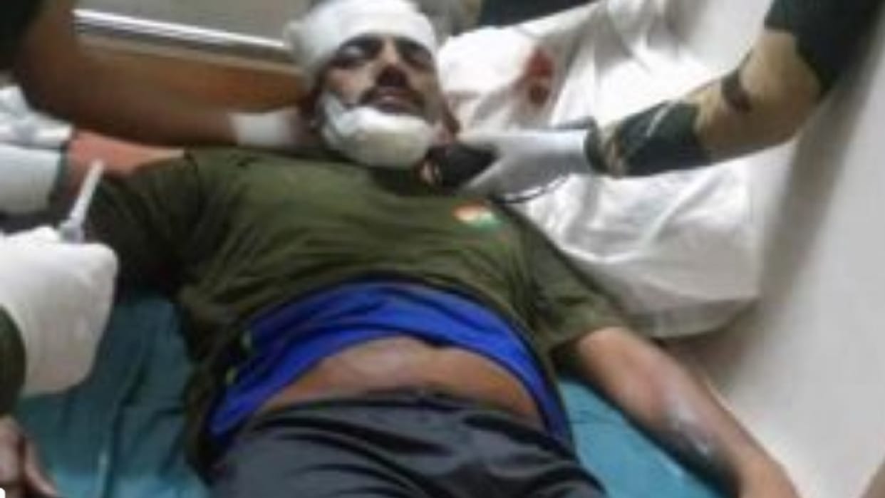 BSF jawan injured in IED blast before CM's bhupesh baghel visit in chattisgarh kanker