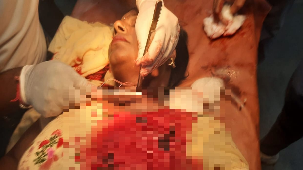 Teacher s neck cut after being hit by Chinese manja on Hospital Road in Rampur 22 stitches