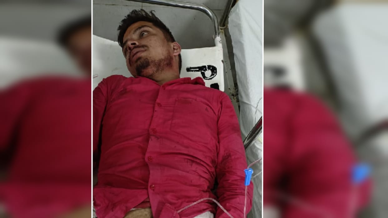 Gangesh injured in knife attack referred to Lucknow case registered