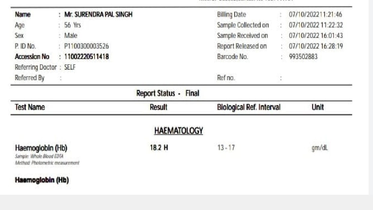 Tested in three labs, the report of all three came out different