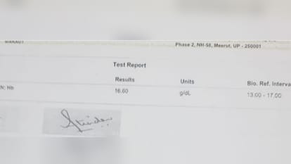 Tested in three labs, the report of all three came out different