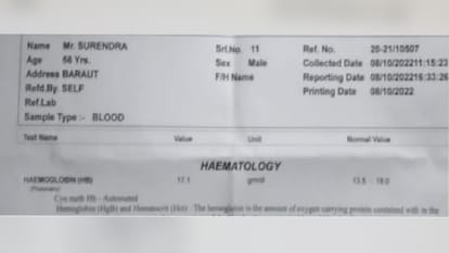 Tested in three labs, the report of all three came out different