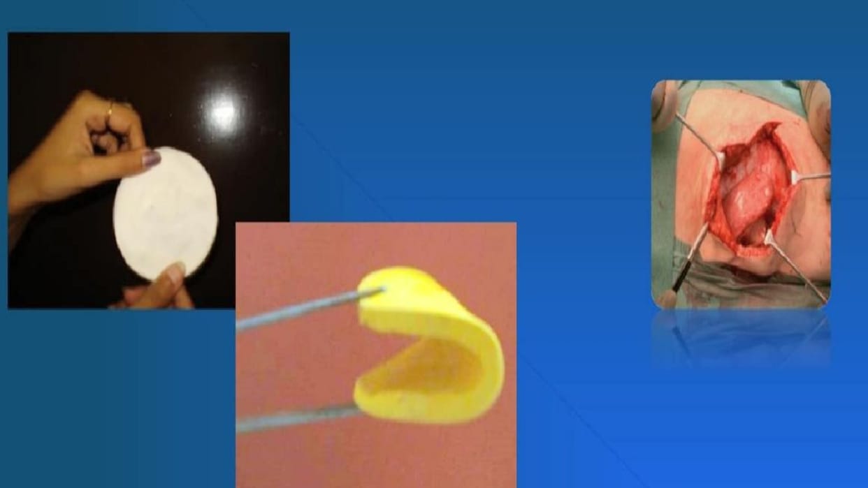Herbal strips made of turmeric neem will not allow infection on wounds