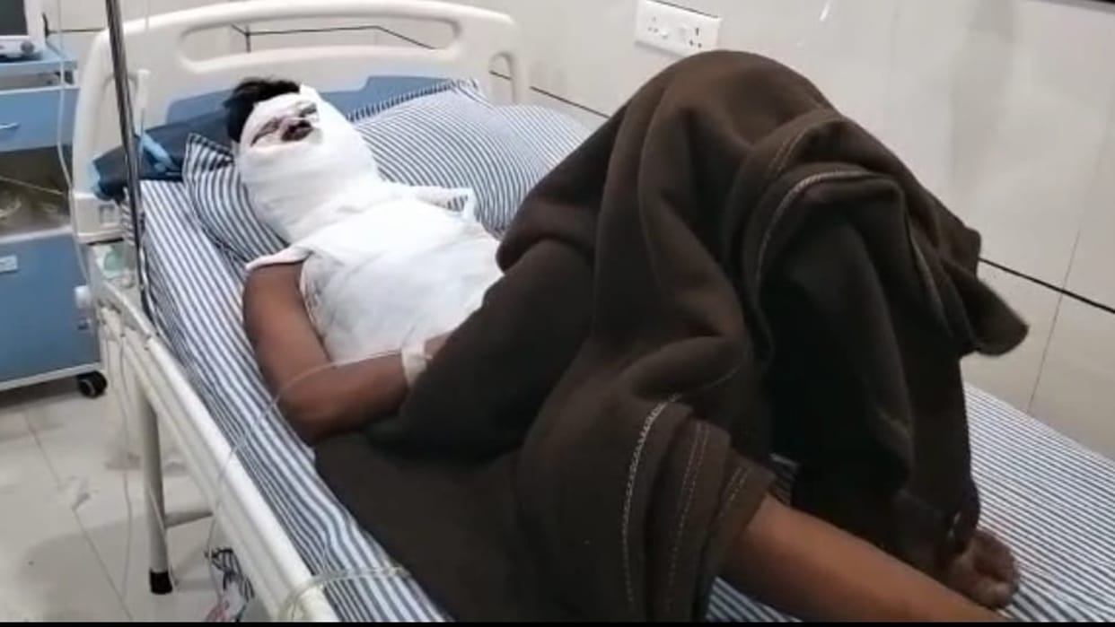 Acid thrown at youth after dispute in Chhindwara referred to Nagpur in critical condition