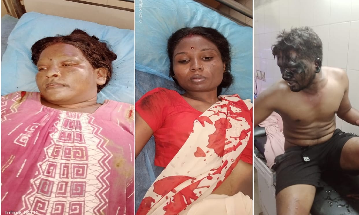 3 injured including couple due to cylinder fire in chhattisgarh korba