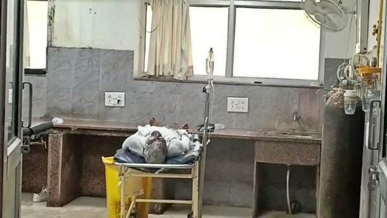 Priest Sets Himself on fire by pouring kerosene in Ajmer