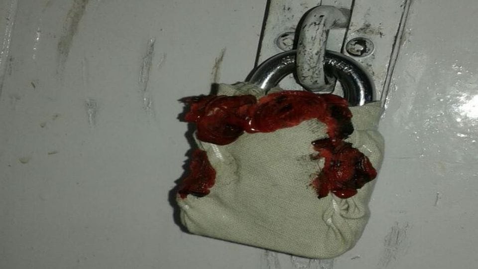 Balaghat: Two medical shops selling banned codeine cough syrup sealed, district administration action