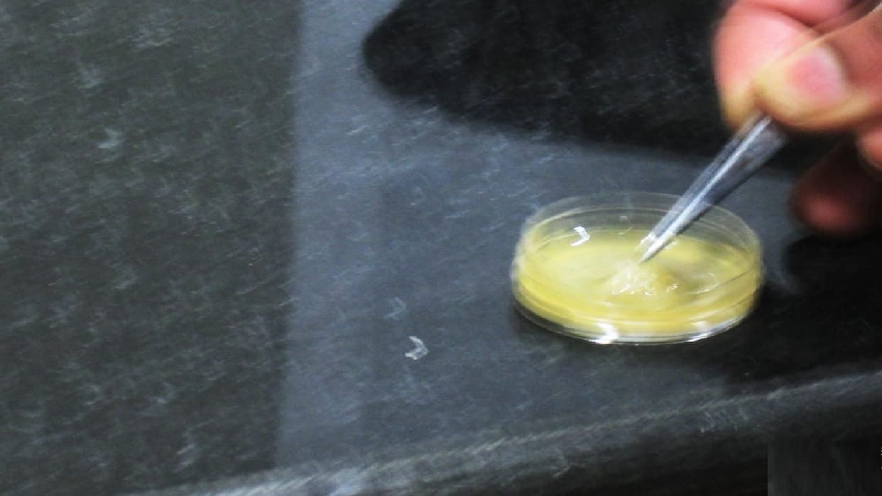 Now there is no need to transplant, tissue engineering will repair human organs