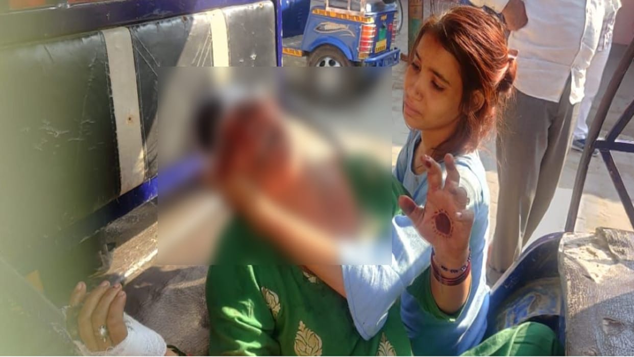 Conflict between two sides for dispute in Baghpat and ten people injured including woman
