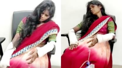 Husband breaks wife hands and feet for dowry Woman pleaded with CM Shivraj in Gwalior