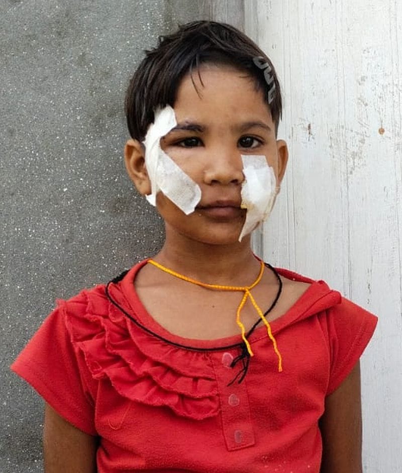 The jackal dragged the seven-year-old girl into the cane