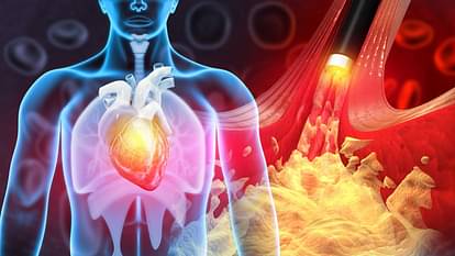 vitamin B supplement niacin could increased risk of heart disease and heart attack