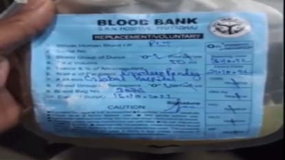 Fake platelets case beli used to play with fake slips of SRN Hospital and AMA